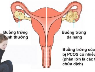 anh-huong-cua-rau-ngot-voi-ba-bau